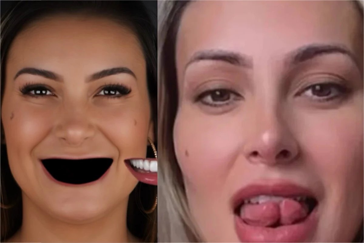 Após quebrar a língua ao meio, Andressa Urach publica vídeo ‘desdentada’