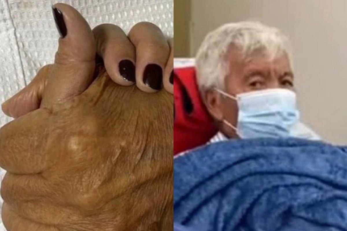 Triste, esposa age rápido ao ver Roque, ex-assistente de Silvio Santos, consumido e o leva ao hospital