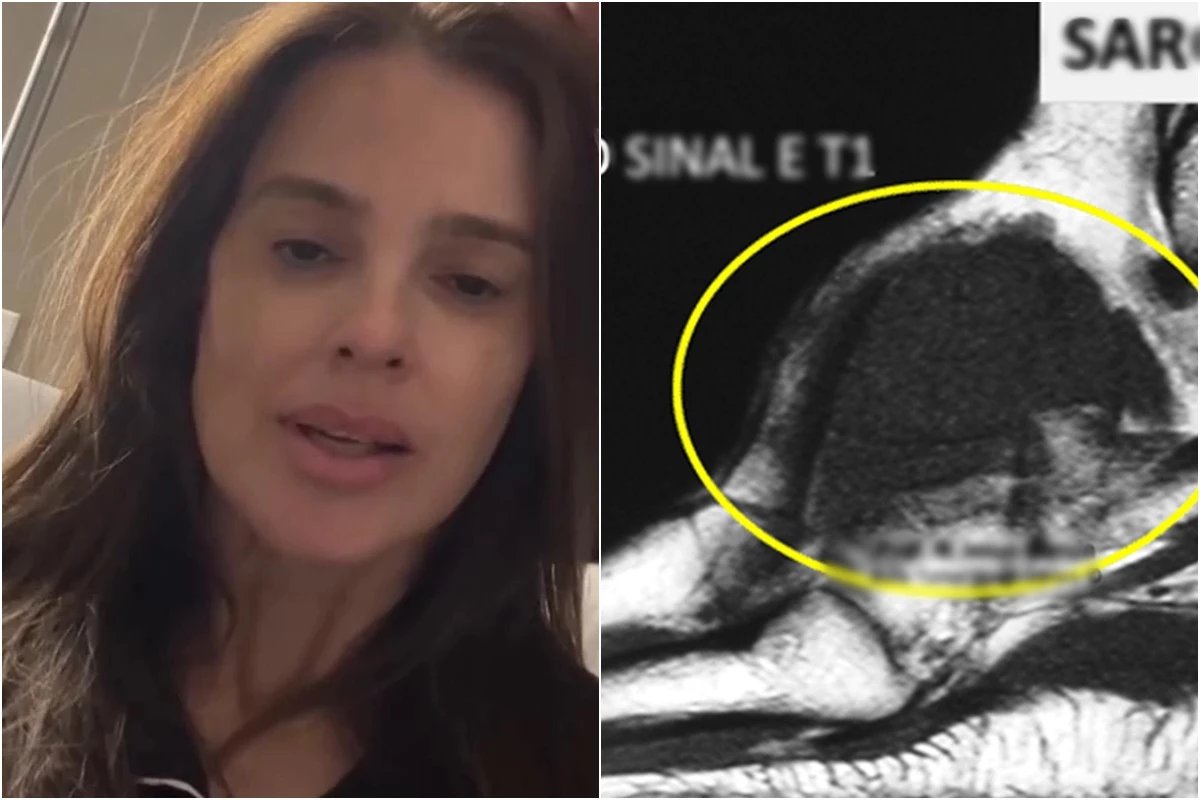 Mulher de Rodrigo Faro aparece de muletas no hospital após passar por cirurgia para retirada de tumor maligno: ‘milagres’