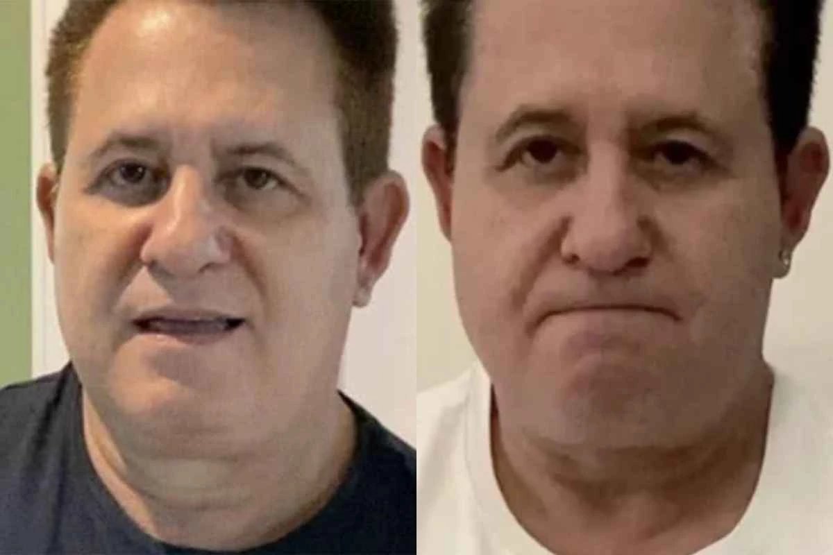 Cantor Marrone, da dupla com Bruno, desabafa sobre as cirurgias: ‘ele estava abatido’
