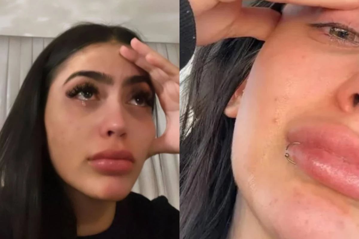 MC Mirella é levada às pressas para o hospital; Os médicos fizeram uma tomografia computadorizada e descobriram o diagnóstico.