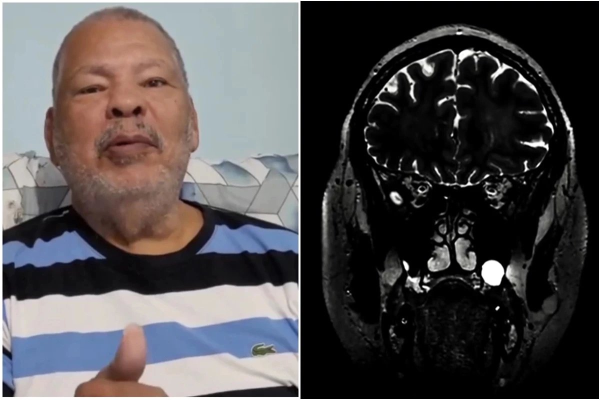 Maguila autorizou a doação de seu cérebro à USP; A decisão final dependerá da família.