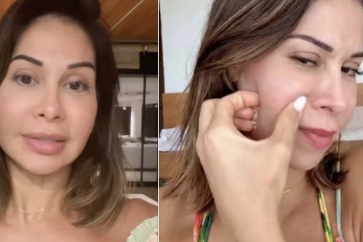 Maíra Cardi revela complicações em procedimentos estéticos e cita Andressa Urach: ‘Perdendo circulação’