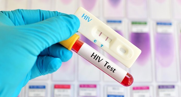 Aids: Brasil tem aumento de casos, mas mortalidade menor desde 2013