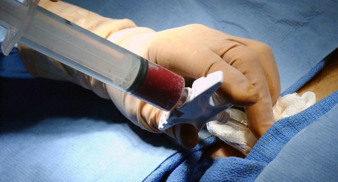Doação de Medula Óssea: Entenda a importância e saiba como se tornar um doador