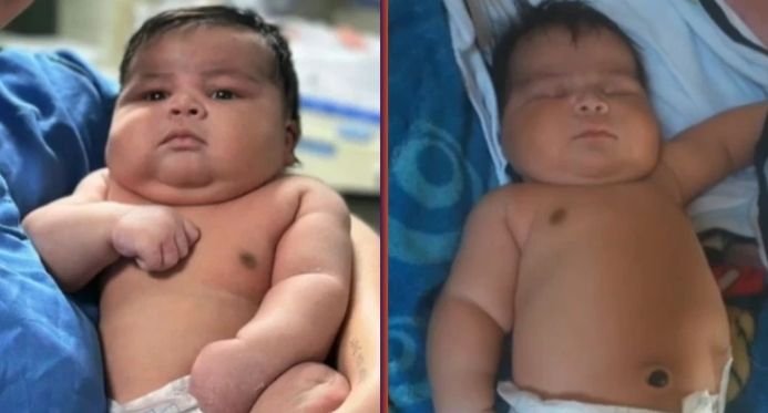 Sesa investiga o nascimento de um bebê de 6,5 kg que feriu a mãe e o recém -nascido em Colatina