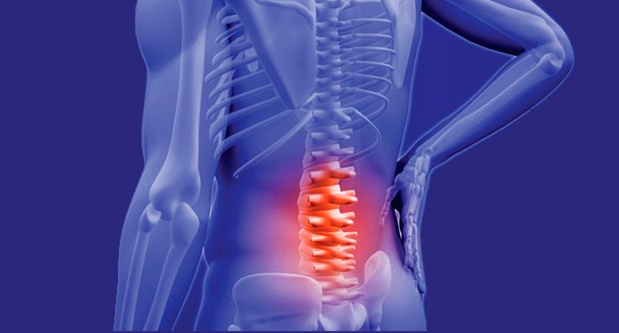 Dor lombar é um dos principais motivos de procura de consulta médica