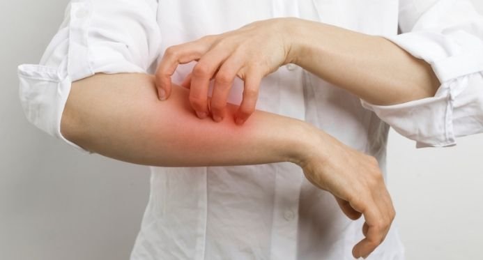 Sarna humana atinge oito alunos de escola rural de São Mateus