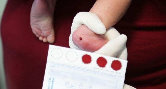 Teste do Pezinho será ampliado para detectar doenças raras em bebês no ES