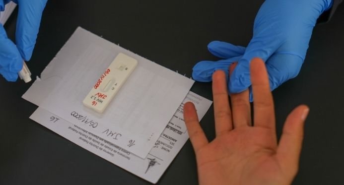 Governo busca acordo para produzir prevenção injetável de longa duração do HIV