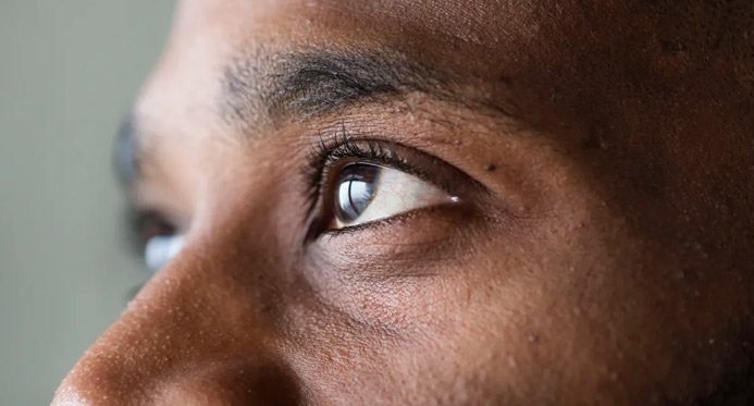 “Tendência” nas redes sociais, raspar os cílios pode causar lesões oculares