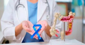 Espera-se que as mortes por câncer colorretal aumentem quase 3 vezes até 2030