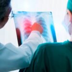Anvisa aprova novo medicamento para casos avançados de câncer de pulmão – Em Dia ES