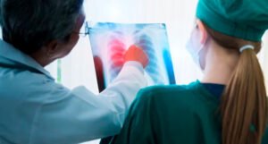 Anvisa aprova novo medicamento para casos avançados de câncer de pulmão – Em Dia ES