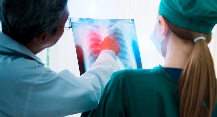 Anvisa aprova novo medicamento para casos avançados de câncer de pulmão – Em Dia ES