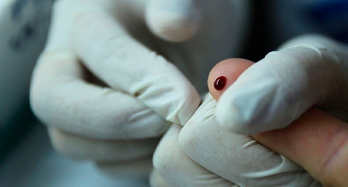 Brasil atinge meta e solicita selo internacional de eliminação da hepatite B de mãe para filho – Em Dia ES