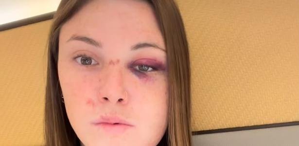 Eduarda Bordignon após sofrer acidente durante etapa da Copa do Mundo de Ciclismo BMX